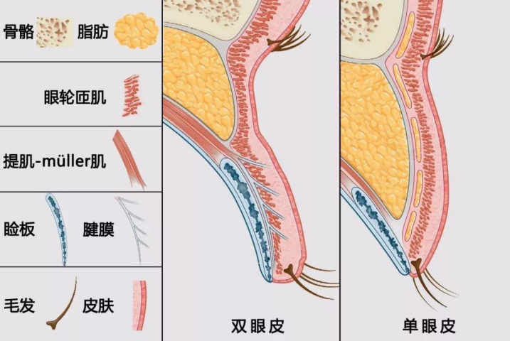 双眼皮胶用久了真的会变成双眼皮吗？
