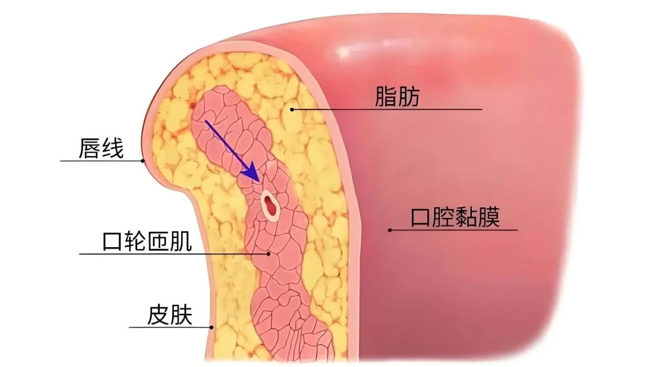 吴宇萌：唇部注射，到底该打哪个层次？